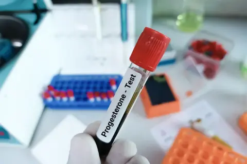 Probówka z napisem "Progesterone - Test" w laboratorium. Badanie progesteronu u kobiet jest kluczowe w diagnostyce cyklu miesiączkowego i ciąży.