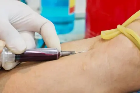 Jak przygotować się do badania cholesterolu, aby uniknąć błędów