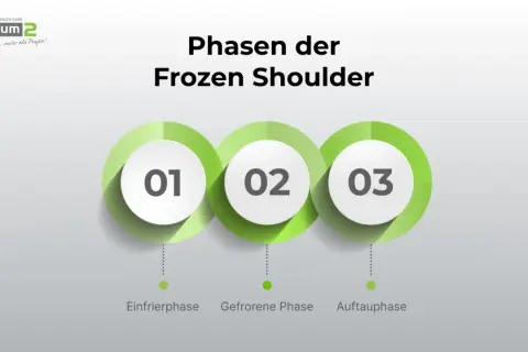 Phasen der Frozen Shoulder: Einfrier-, Gefrorene- und Auftauphase. Psychische Ursachen können die Heilung beeinflussen.