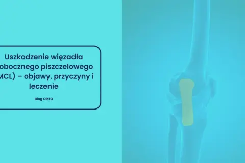 Ilustracja przedstawia uszkodzenie więzadła pobocznego piszczelowego (MCL) w stawie kolanowym.