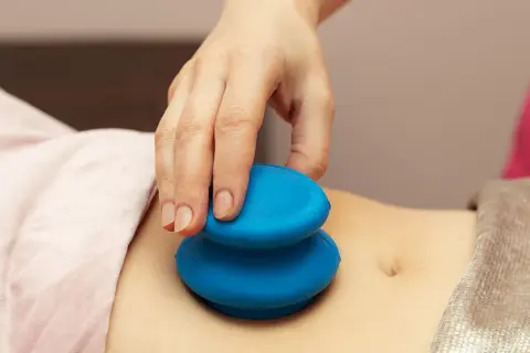 Dłoń terapeuty wykonuje masaż brzucha niebieskimi bańkami. Choć masaż bańką chińską efekty uboczne są rzadkie, warto znać potencjalne skutki.