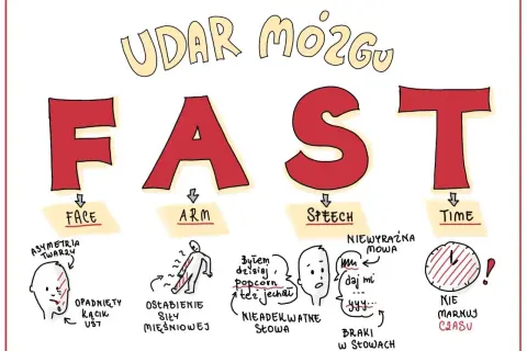 FAST - objawy udaru mózgu: opadnięta twarz, osłabienie ręki, niewyraźna mowa, brak czasu.