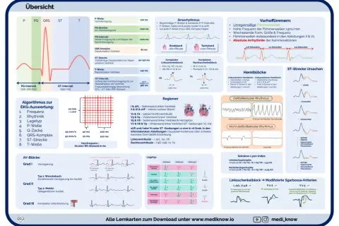 EKG-Schema erklärt Herzinfarkt-Anzeichen: ST-Strecken-Veränderungen wie bei STEMI, Perikarditis oder Tachykardien.