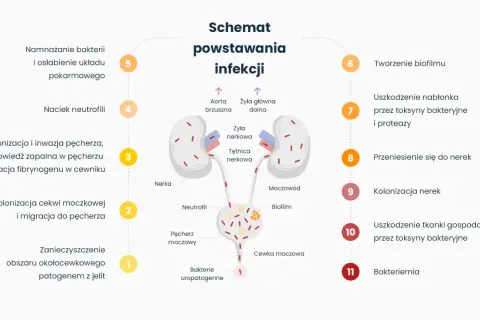 Schemat powstawania infekcji dróg moczowych, od zanieczyszczenia do bakteriemii. Czy zapalenie pęcherza jest zaraźliwe? Schemat pokazuje drogę infekcji.