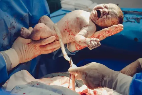 Nowe życie, pierwsza doba po cesarce. Dziecko trzymane przez dłonie w rękawiczkach, z pępowiną.