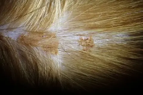 Primer plano de la piel de un gato con verrugas, mostrando lesiones cutáneas y pelaje dorado.