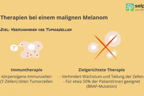 Illustrationen zeigen zwei Therapien gegen Melanom: Immuntherapie mit T-Zellen, die Tumorzellen angreifen, und zielgerichtete Therapie, die Zellwachstum stoppt.