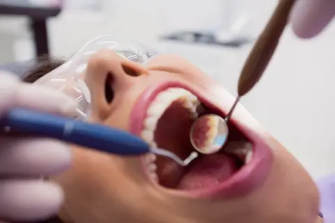Zabieg piaskowania zębów w gabinecie stomatologicznym. Dentysta używa lusterka i piaskarki do oczyszczenia uzębienia.