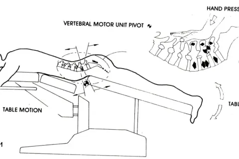 Ilustracja pokazuje technikę terapii manualnej kręgosłupa, która może pomóc w odpowiedzi na pytanie: czy wypuklina może się cofnąć.