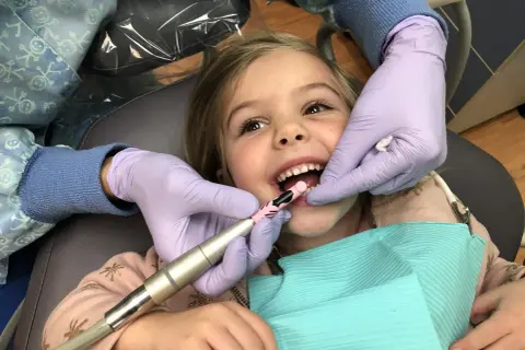 Uśmiechnięta dziewczynka przechodzi zabieg lapisowania zębów. Dentysta w rękawiczkach delikatnie czyści jej ząbki.