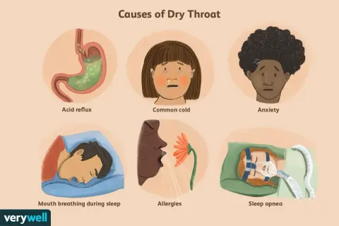 Illustration shows causes of dry throat: acid reflux, common cold, anxiety, mouth breathing during sleep, allergies, and sleep apnea.
