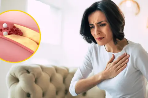 Jaki lekarz leczy cholesterol? Sprawdź, kto pomoże obniżyć jego poziom