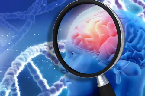 Badanie mózgu pod lupą, szukając przyczyn katatonii. DNA w tle sugeruje genetyczne podłoże.