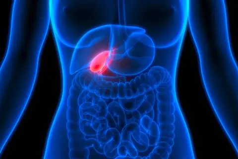 Anatomie humaine, vésicule biliaire rouge vif, suggérant une douleur au foie et au dos.