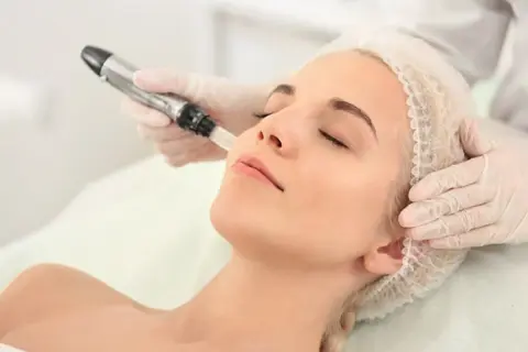 Profesional aplica tratamiento con Dermapen, una técnica para la piel que ayuda a entender la diferencia entre mesoterapia y dermapen.