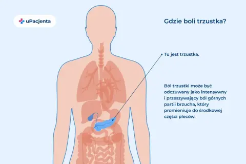 Anatomia człowieka z zaznaczoną trzustką. Ból trzustki odczuwany jest w górnej części brzucha, promieniując do pleców.
