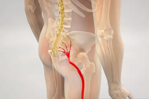 Widok anatomiczny ukazujący nerw kulszowy w czerwonym kolorze, biegnący od miednicy w dół nogi, aż do stopy.