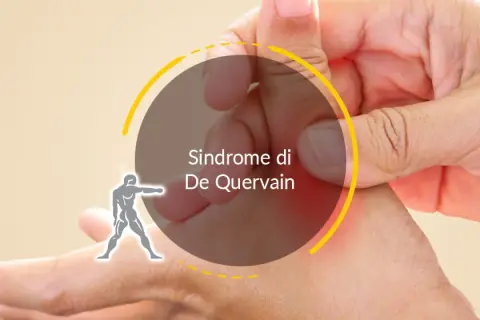 Mano con pollice piegato, evidenziata un'area rossa che indica dolore, tipico della tendinite polso.