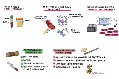 Eine **liquid biopsy** wird aus Blut oder Urin entnommen, um zirkulierende Tumorzellen, Proteine, Biomarker und RNA-Veränderungen zu analysieren. Sie ist weniger invasiv und sicherer als eine Gewebebiopsie.