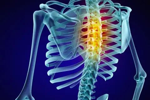 Ból od osteofitów? Skuteczna rehabilitacja przywróci Ci sprawność