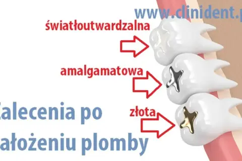 Palenie po wizycie u dentysty: Kiedy jest bezpieczne?