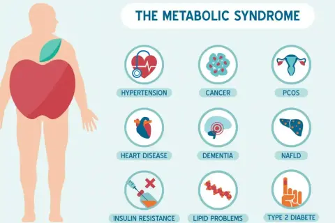 Ilustracja przedstawia sylwetkę człowieka z jabłkiem w brzuchu, symbolizującym zespół metaboliczny. Obok ikony wskazujące na nadciśnienie, raka, PCOS, choroby serca, demencję, NAFLD, insulinooporność, problemy z lipidami i cukrzycę typu 2.