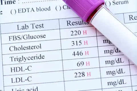 Wyniki badań krwi: glukoza, cholesterol, trójglicerydy, HDL-C, LDL-C. Szybko uzyskane dane do analizy.