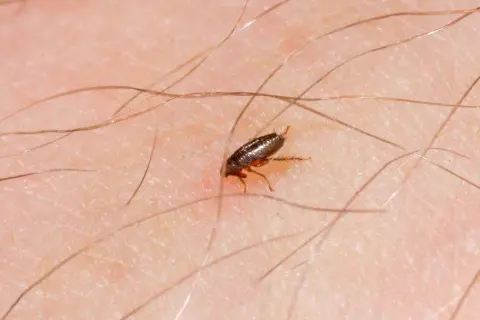 Cómo saber si tengo pulgas en mi cama: señales que no debes ignorar