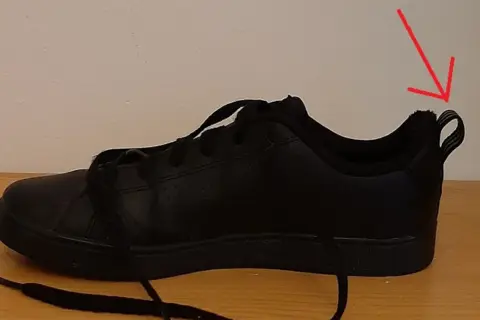 Kiedy buty są za małe? Objawy, które mogą cię zaskoczyć