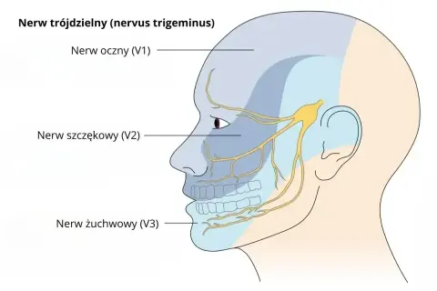 Schematyczny rysunek głowy z zaznaczonymi obszarami unerwienia nerwu trójdzielnego: nerw oczny (V1), szczękowy (V2) i żuchwowy (V3).