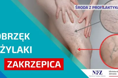 Jak zapobiec zakrzepicy? Skuteczna profilaktyka krok po kroku