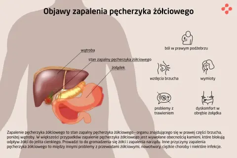 Anatomia i objawy zapalenia pęcherzyka żółciowego: ból, wzdęcia, wymioty, problemy z trawieniem.