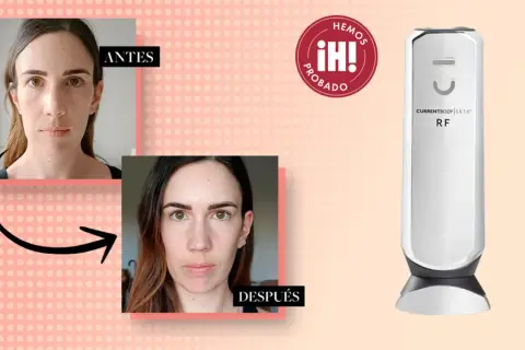 Comparativa antes y después de un tratamiento de radiofrecuencia facial. Dispositivo RF CurrentBody Skin.