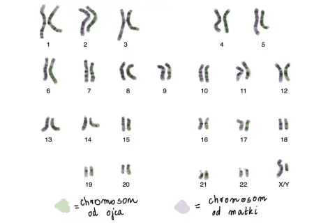 Kariotyp człowieka: 23 pary chromosomów, w tym 22 pary autosomów i 1 para chromosomów płci (X/Y).