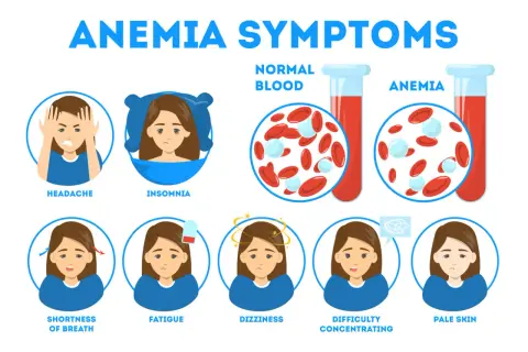 Sintomi di anemia: mal di testa, insonnia, affanno, stanchezza, vertigini, difficoltà di concentrazione, pelle pallida. Il ferro basso quando preoccuparsi è indicato da questi segnali.