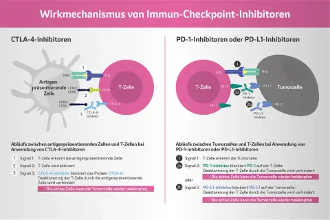 Schema zeigt, wie PD-L1 Immuntherapie T-Zellen aktiviert, um Tumorzellen zu bekämpfen.