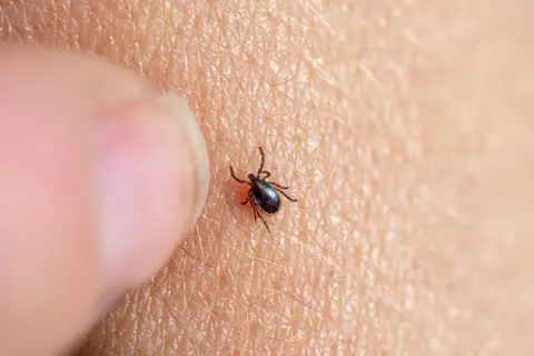 Gros plan d'une tique sur la peau, près d'un doigt. Une tique dans la maison peut être une surprise désagréable.