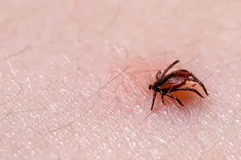 Zbliżenie na ludzką skórę z widocznym, brązowym kleszczem. Pajęczak ma osiem nóg i wyraźnie zaznaczone ciało. Wokół niego widać drobne włoski.