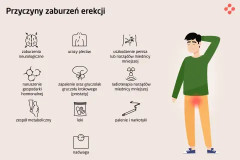 Ilustracja przedstawia przyczyny zaburzeń erekcji: od problemów neurologicznych, przez urazy, choroby prostaty, po zespół metaboliczny, leki, nadwagę, palenie i narkotyki.