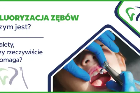 Fluor w stomatologii: czy fluor jest szkodliwy? Zabieg fluoryzacji zębów u dziecka.