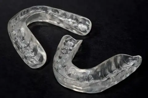Due bite occlusali trasparenti, sagomati per adattarsi all'arcata dentale, su sfondo nero.