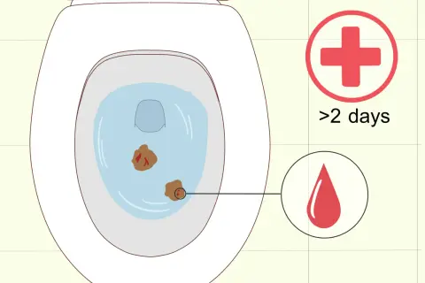 Biegunka w ciąży? W toalecie widać niepokojące objawy. Czerwony krzyż i kropla krwi sugerują, że czas szukać pomocy medycznej, zwłaszcza gdy trwa to dłużej niż 2 dni.
