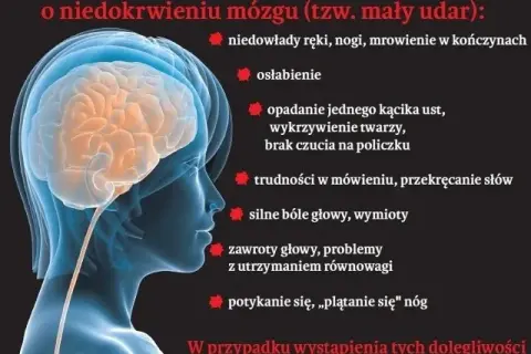 Zmiany malacyjne w mózgu objawy – jak je rozpoznać i co oznaczają?