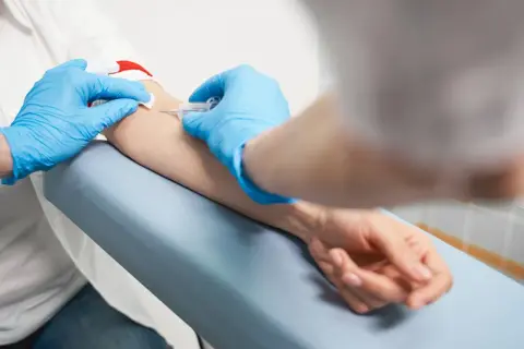 Pobieranie krwi do badań, aby ustalić, kiedy najlepiej badać progesteron.