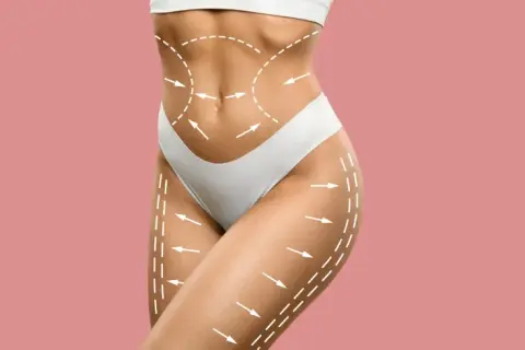 Co to liposukcja? Przewodnik po metodach, efektach i kosztach