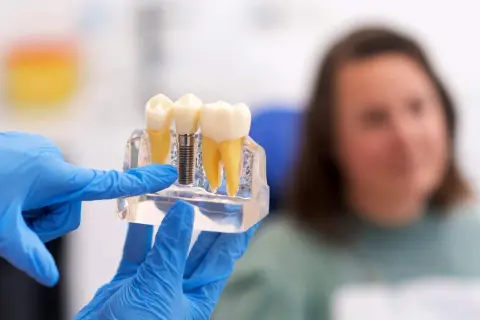 Co robi dentysta? Kompleksowy przewodnik po zdrowiu uśmiechu