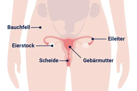 Anatomische Darstellung des weiblichen Beckens mit Gebärmutter, Eierstöcken und Eileitern. Informationen zu Eierstockkrebs, woran stirbt man, sind hier nicht ersichtlich.