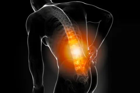Schmerzende Wirbelsäule, die auf Osteochondrose hinweist. Ein Mann hält sich den Rücken, wo die Knochen rot glühen.