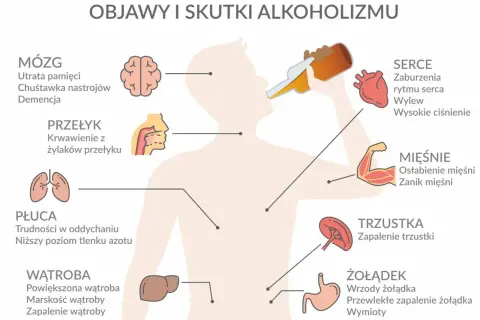 Ilustracja pokazuje skutki alkoholizmu dla mózgu, serca, płuc, wątroby, żołądka, trzustki, mięśni i przełyku.