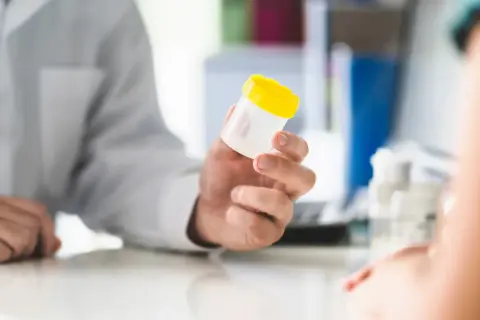 Lekarz podaje pacjentowi pojemnik na próbkę moczu, sugerując obecność erytrocytów świeżych w moczu.